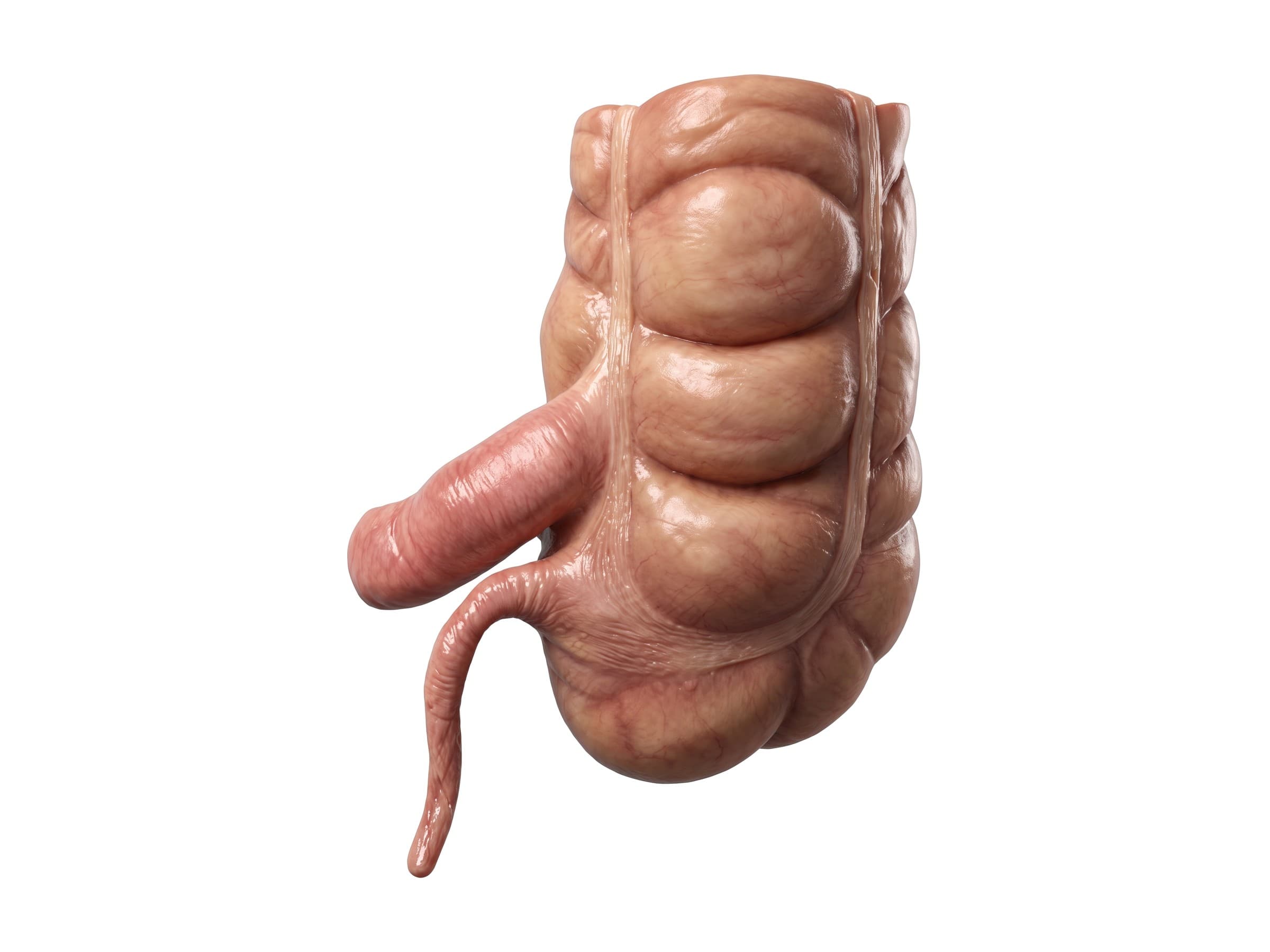 Cecum and appendix (from behind): ileum, ileocecal junction, taeniae coli and haustra