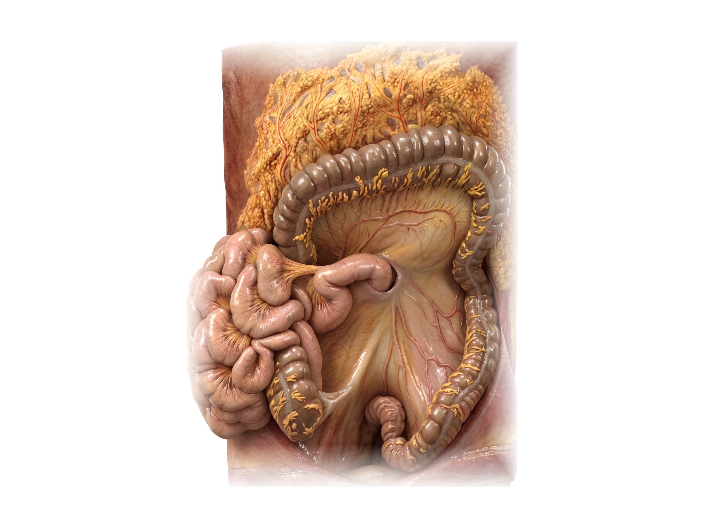 Small intestine and mesentery (front view): jejunum, ileum, cecum and root of the mesentery