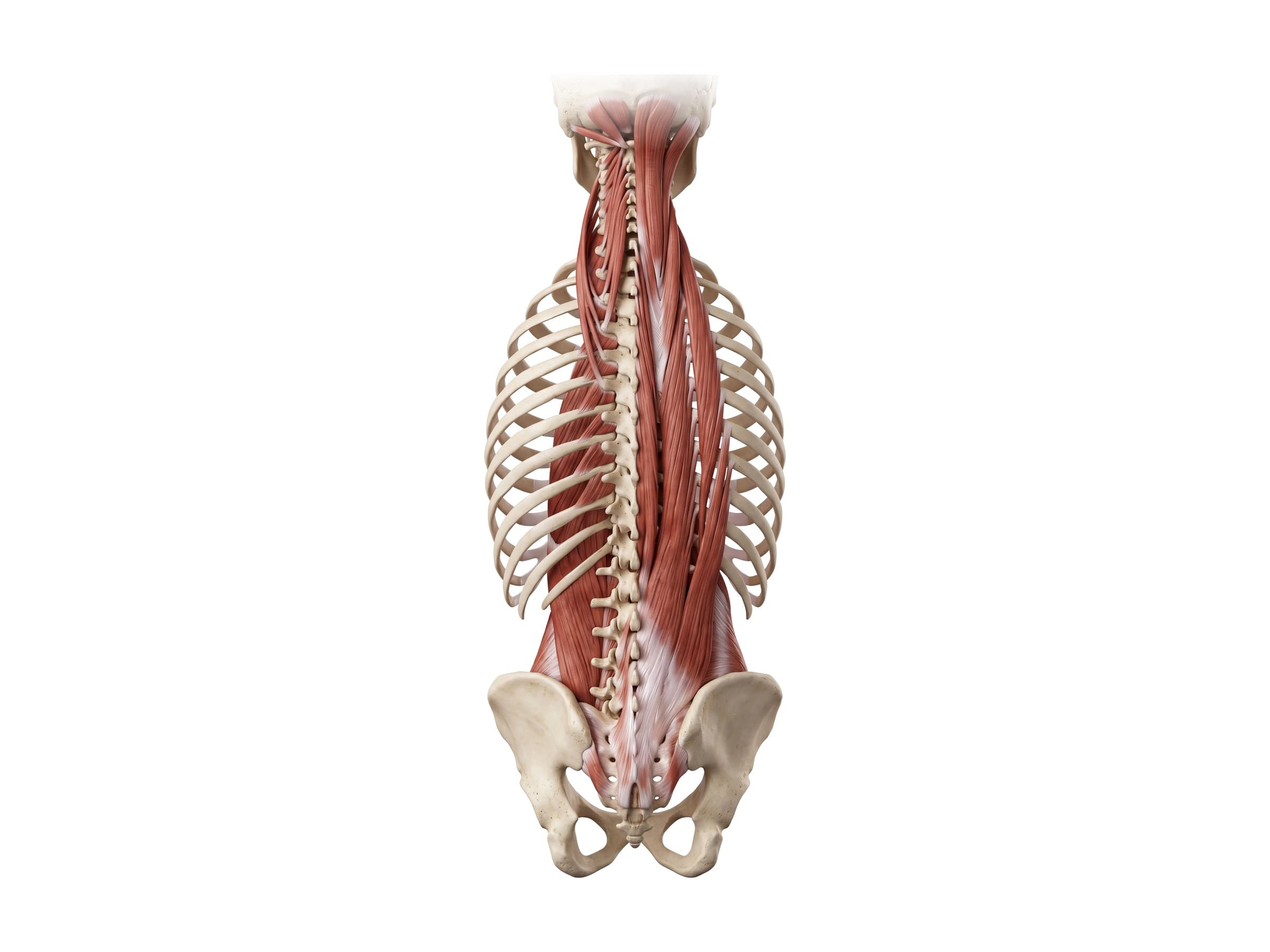 Deep back muscles: erector spinae (iliocostalis, longissimus, spinalis) and multifidus (back view)