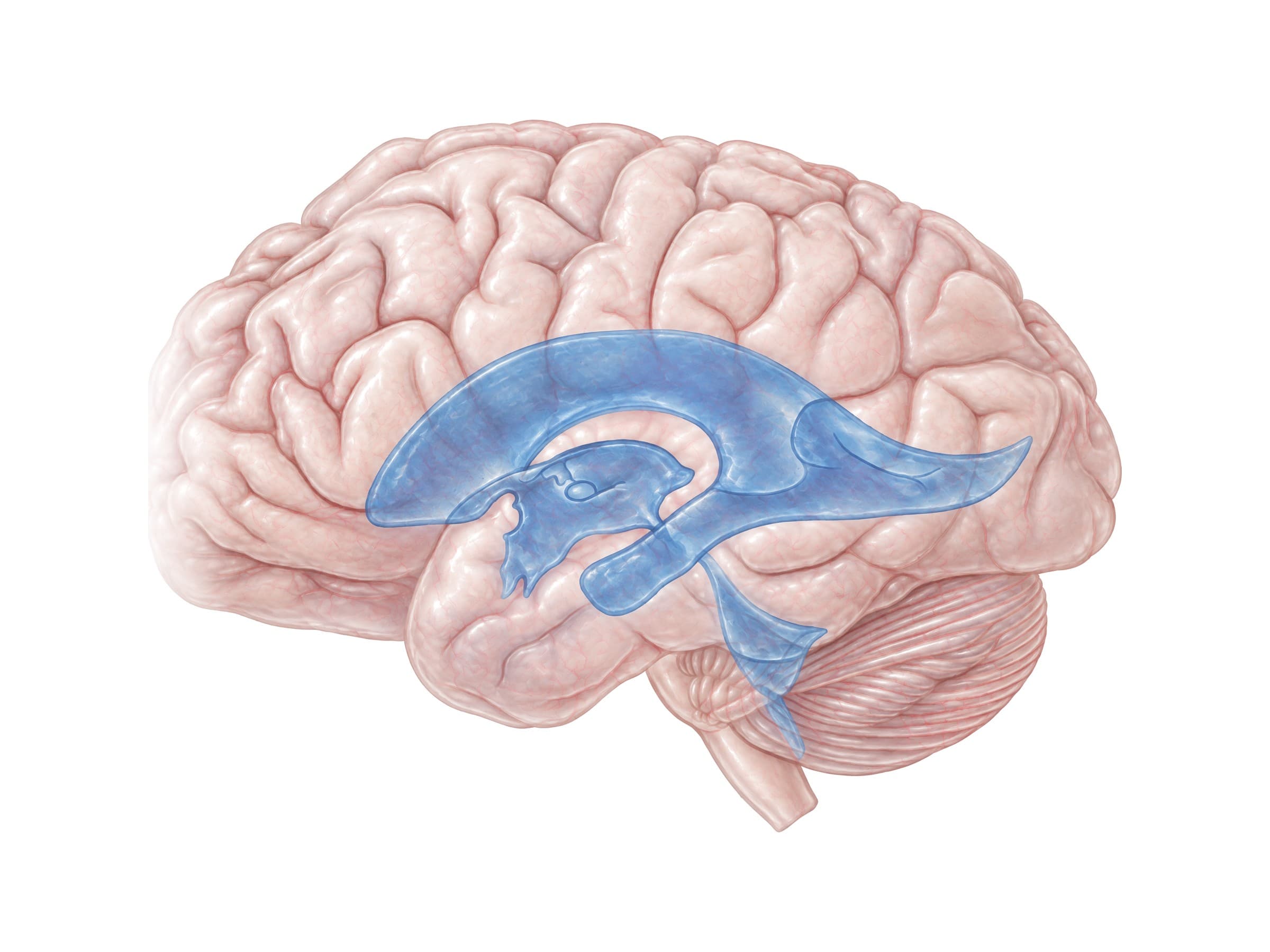Ventricles of the brain (left side view): lateral, third and fourth ventricles and cerebral aqueduct