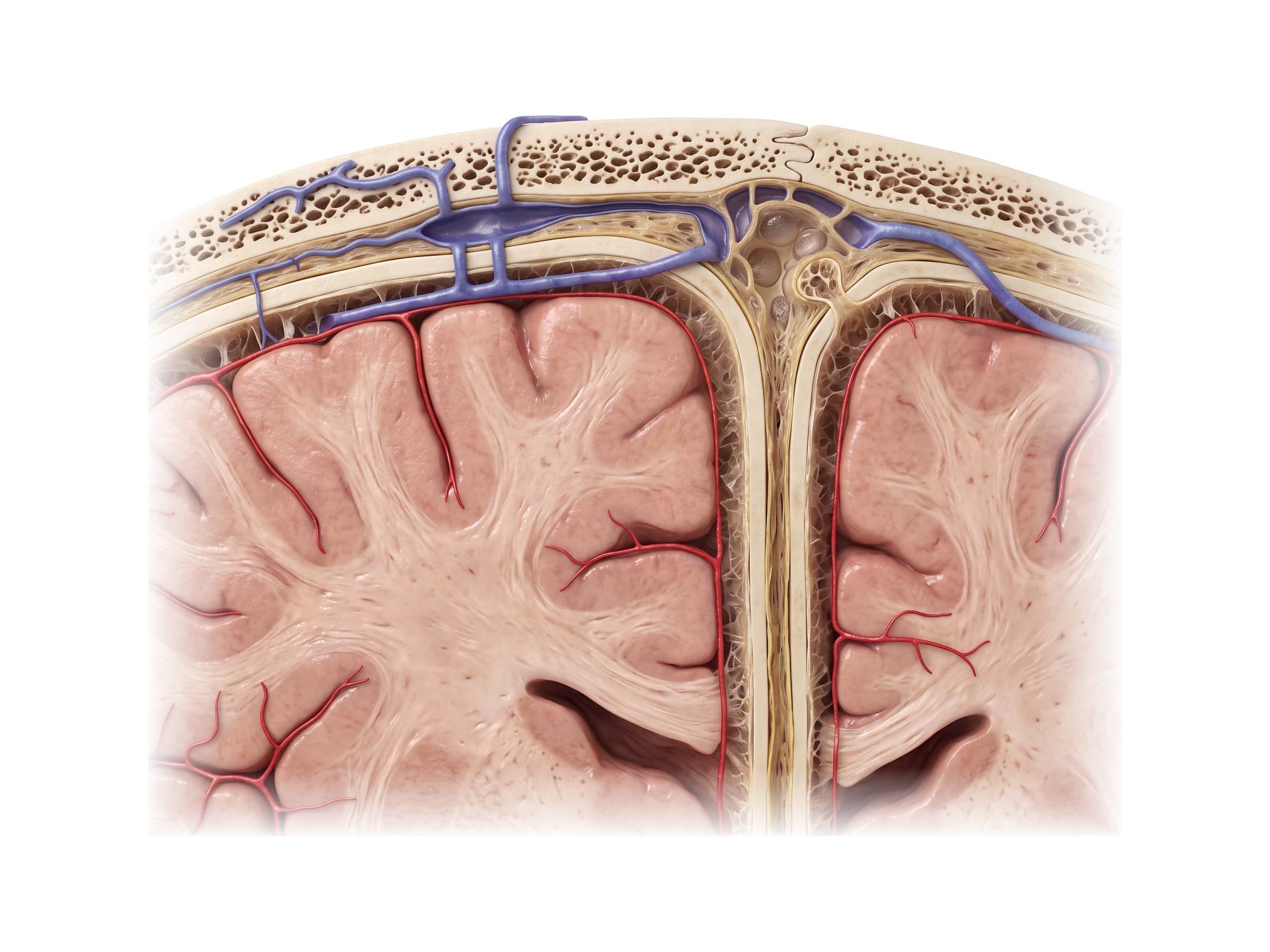 Meninges of the brain (coronal section): dura mater, arachnoid mater, falx cerebri and superior sagittal sinus