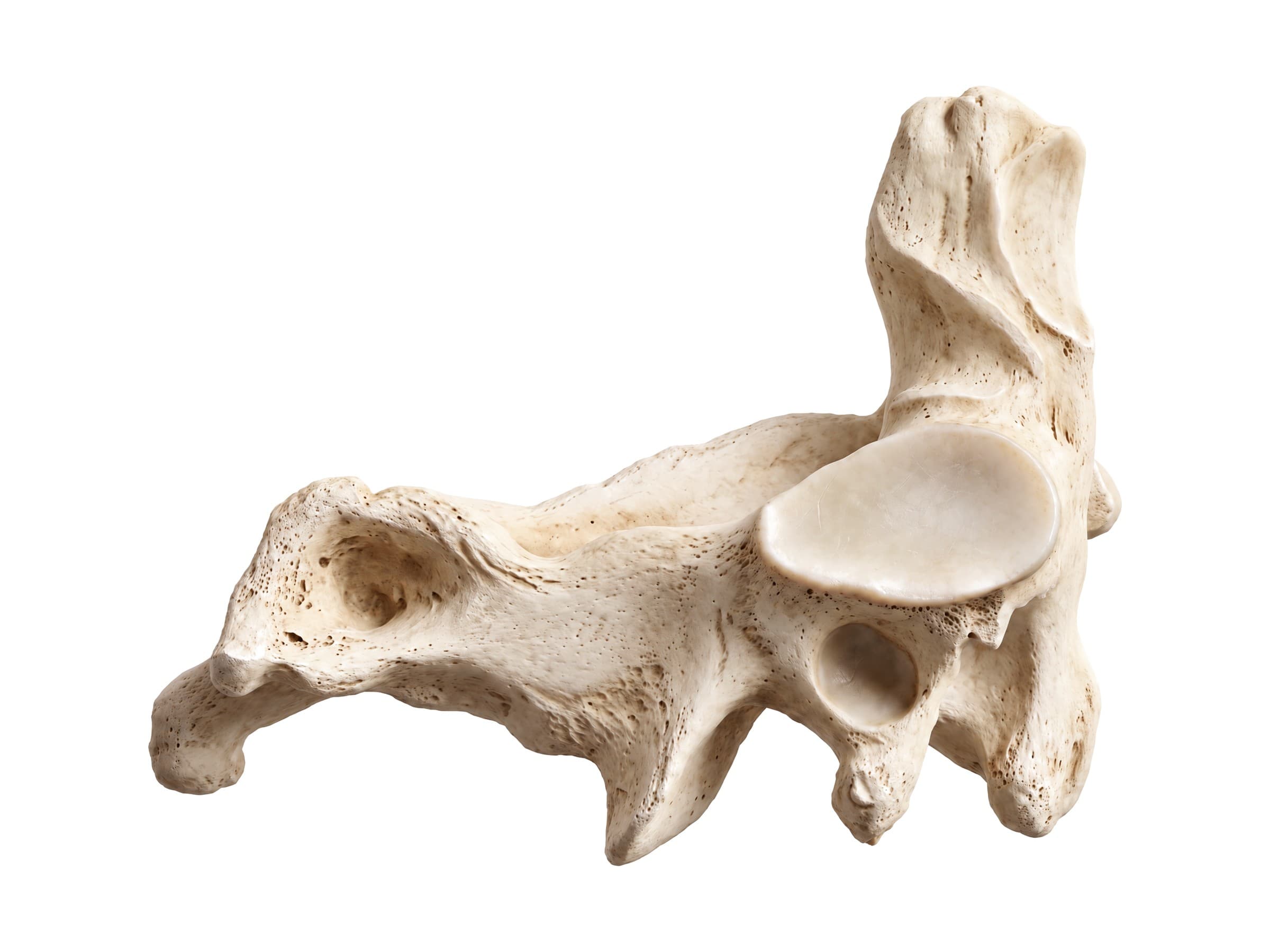 Axis (C2) vertebra (side view): dens, superior articular surface, pars interarticularis and spinous process