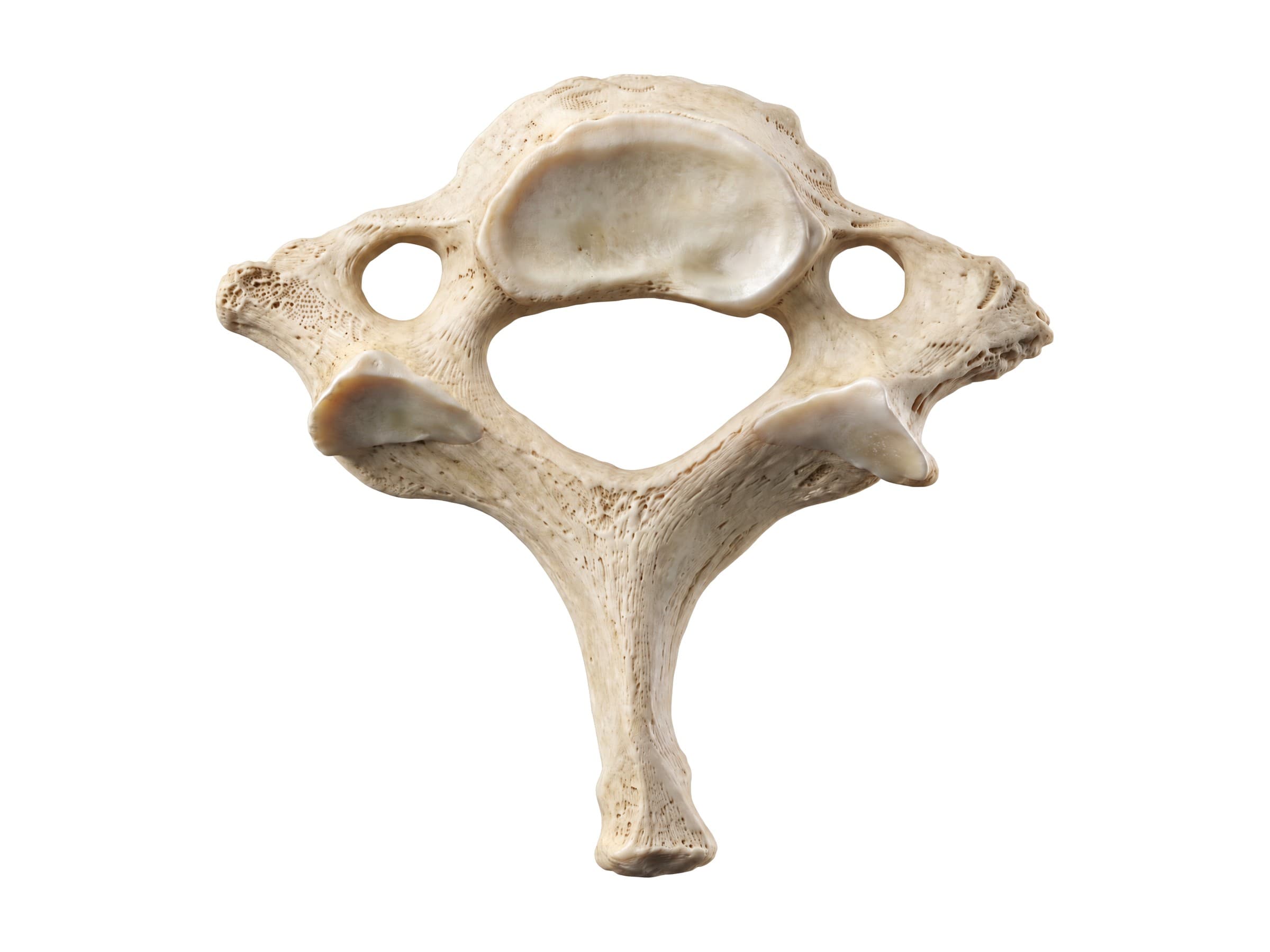 C7 vertebra (vertebra prominens) from above: long spinous process, transverse processes and vertebral canal