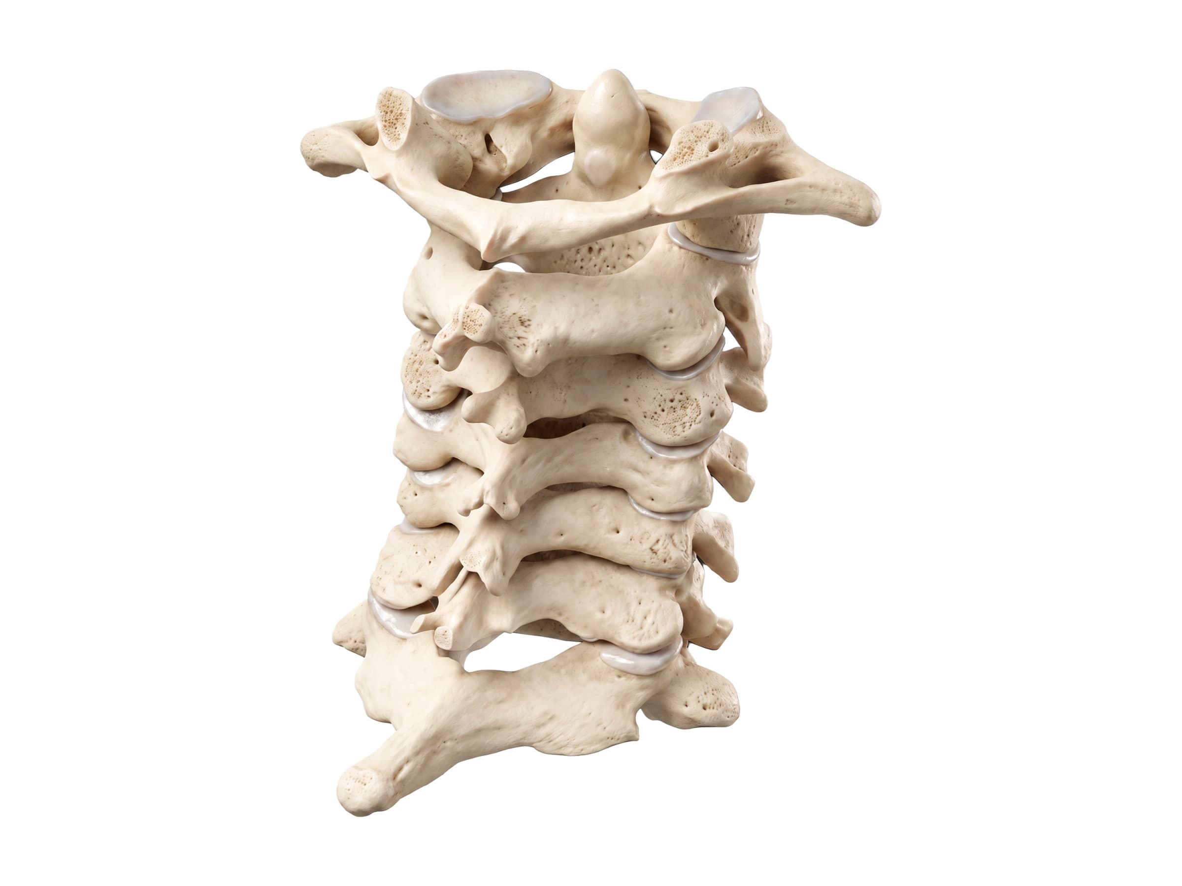 Cervical vertebrae labeled (from behind): atlas, dens of C2, spinous processes and facet joints