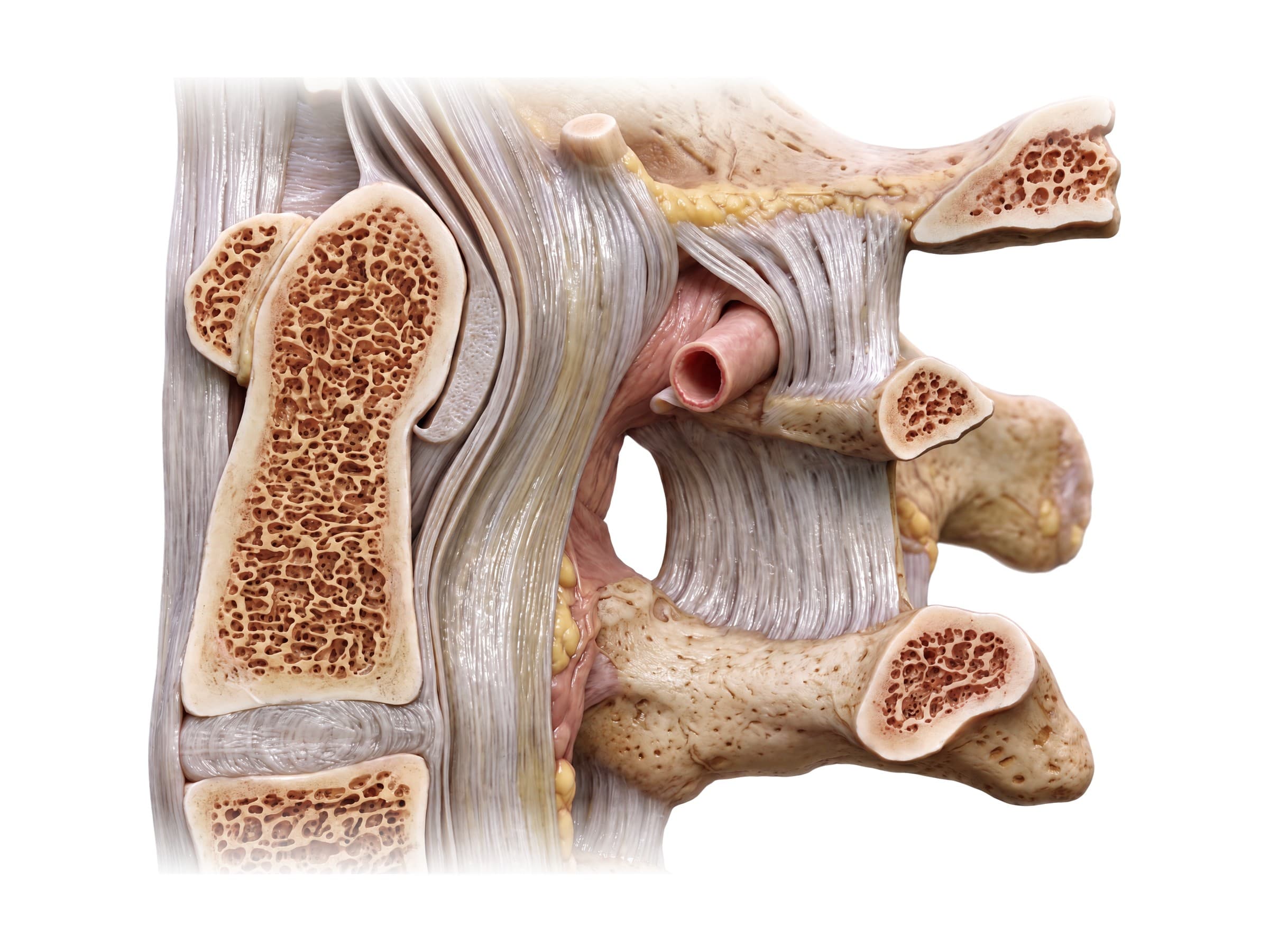 Ligaments of the upper cervical spine (midline section): transverse ligament, membrana tectoria and dens
