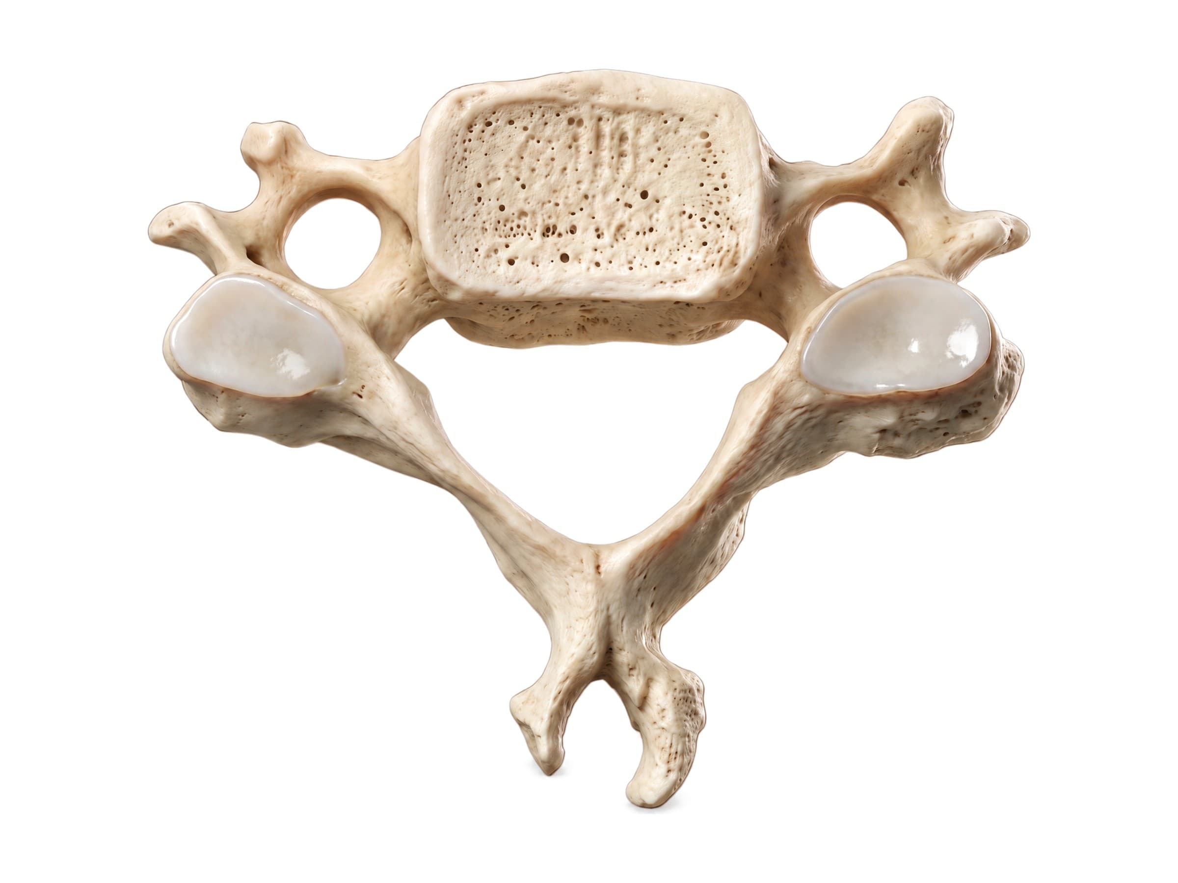 Typical cervical vertebra (top view): body, foramen transversarium, lamina and bifid spinous process