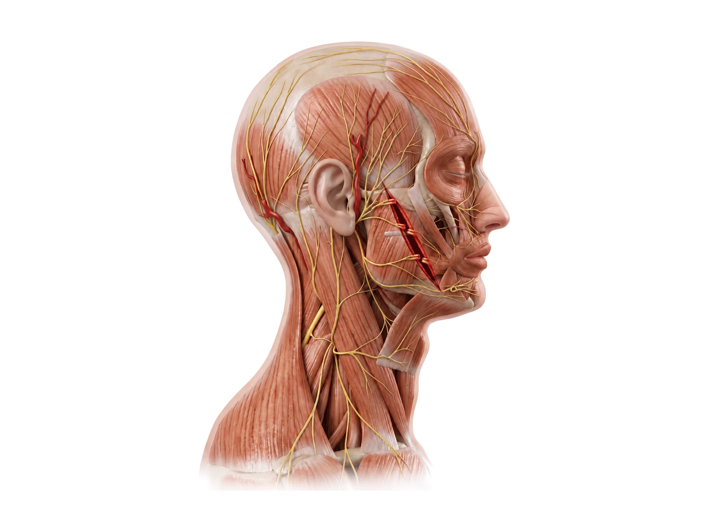 Facial nerve injury: a cheek laceration cutting the zygomatic and buccal branches (right side), in red