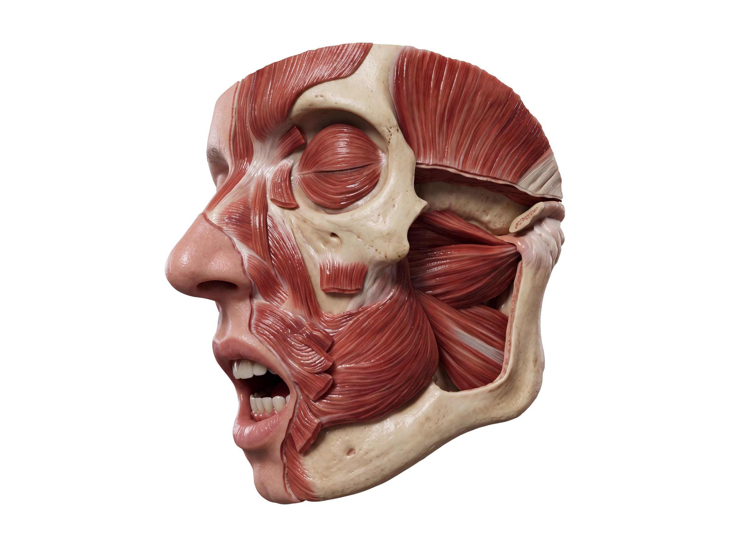 Lateral and medial pterygoid muscles (left side) seen through the cut-away jaw, with the buccinator