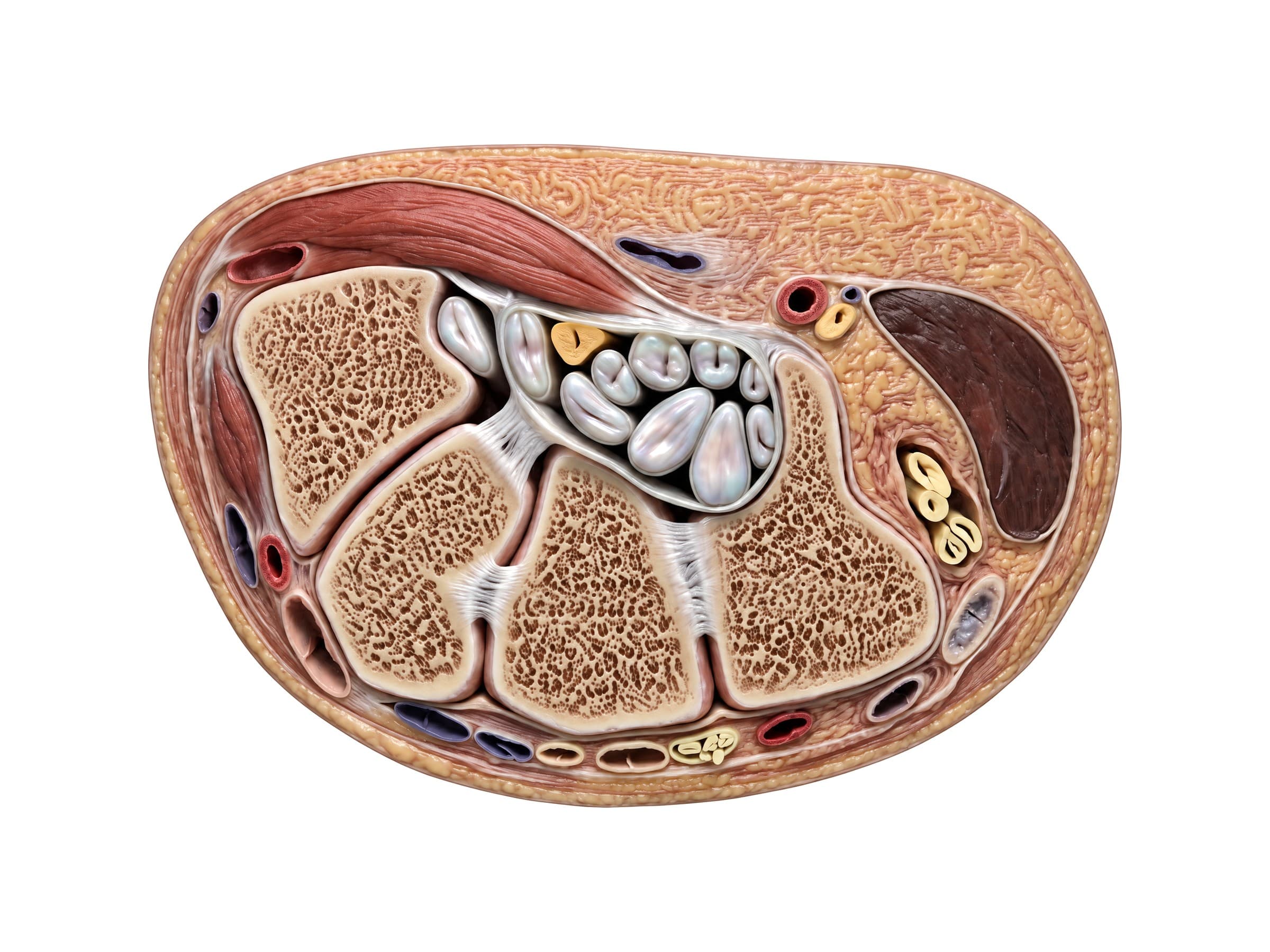 Carpal tunnel cross-section showing the median nerve and flexor tendons