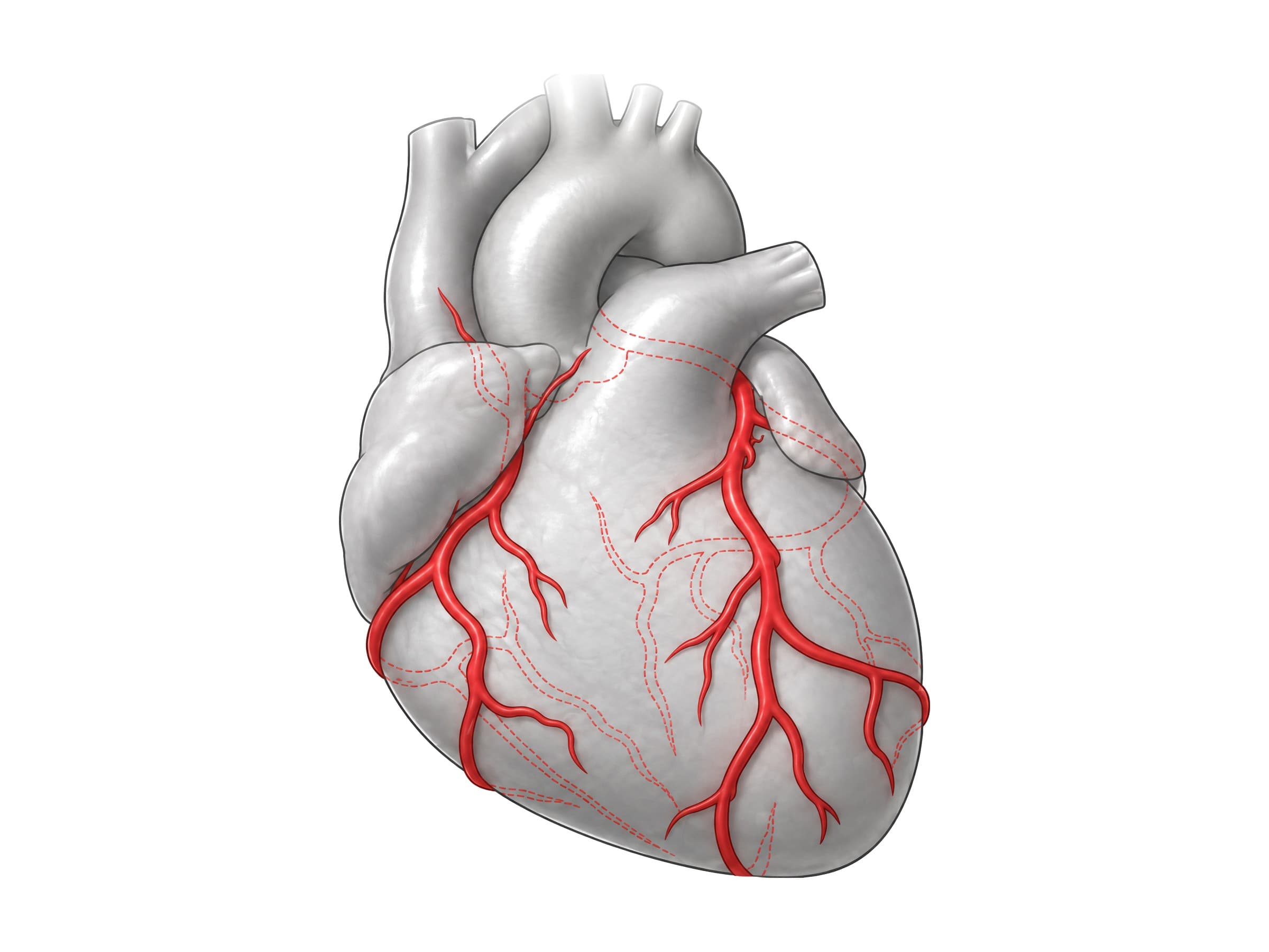 Coronary arteries labeled (front view): RCA, left main, LAD, circumflex, diagonal and marginal branches in red