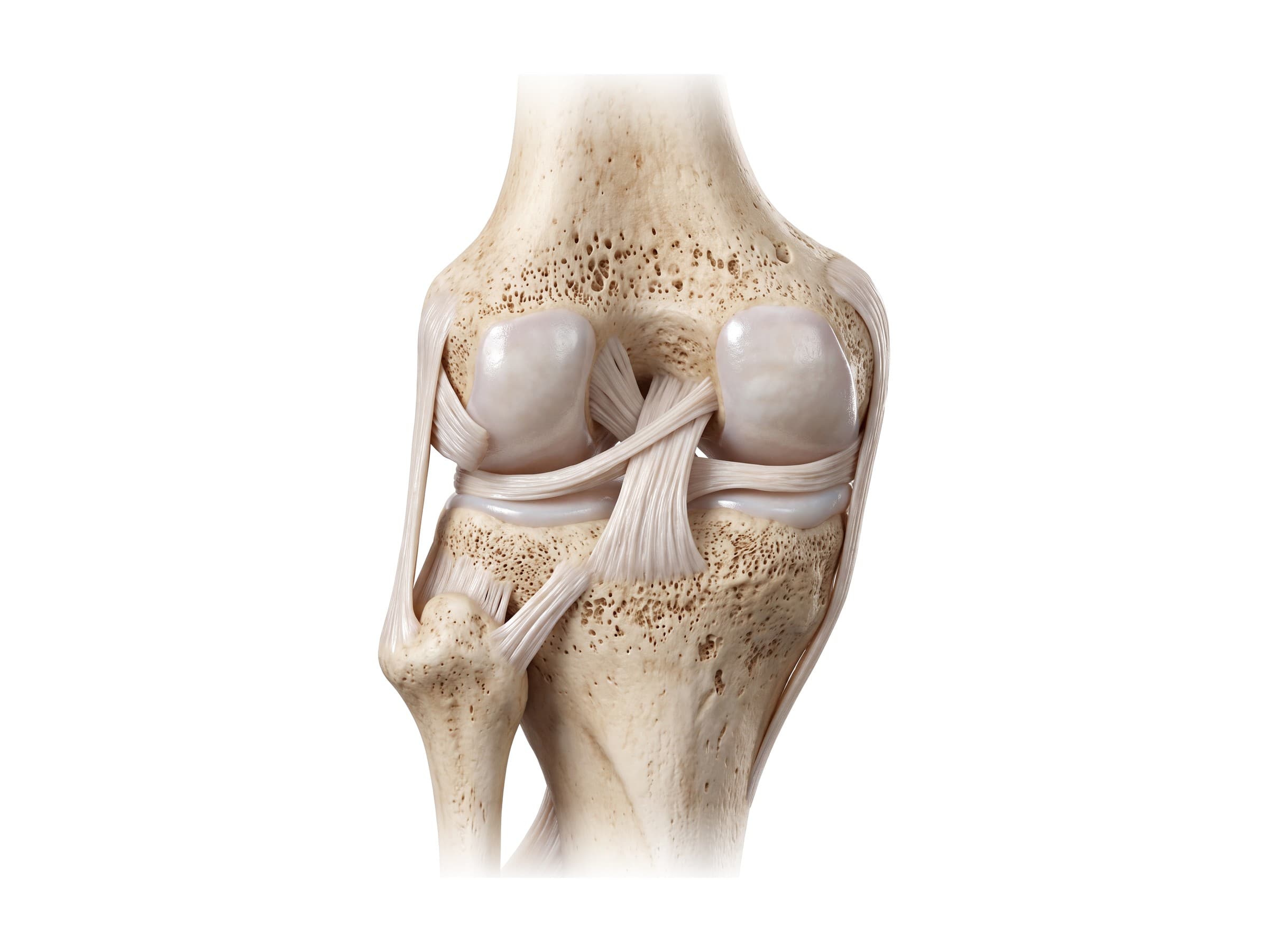 Knee ligaments from behind (left knee): ACL, PCL, menisci and collateral ligaments