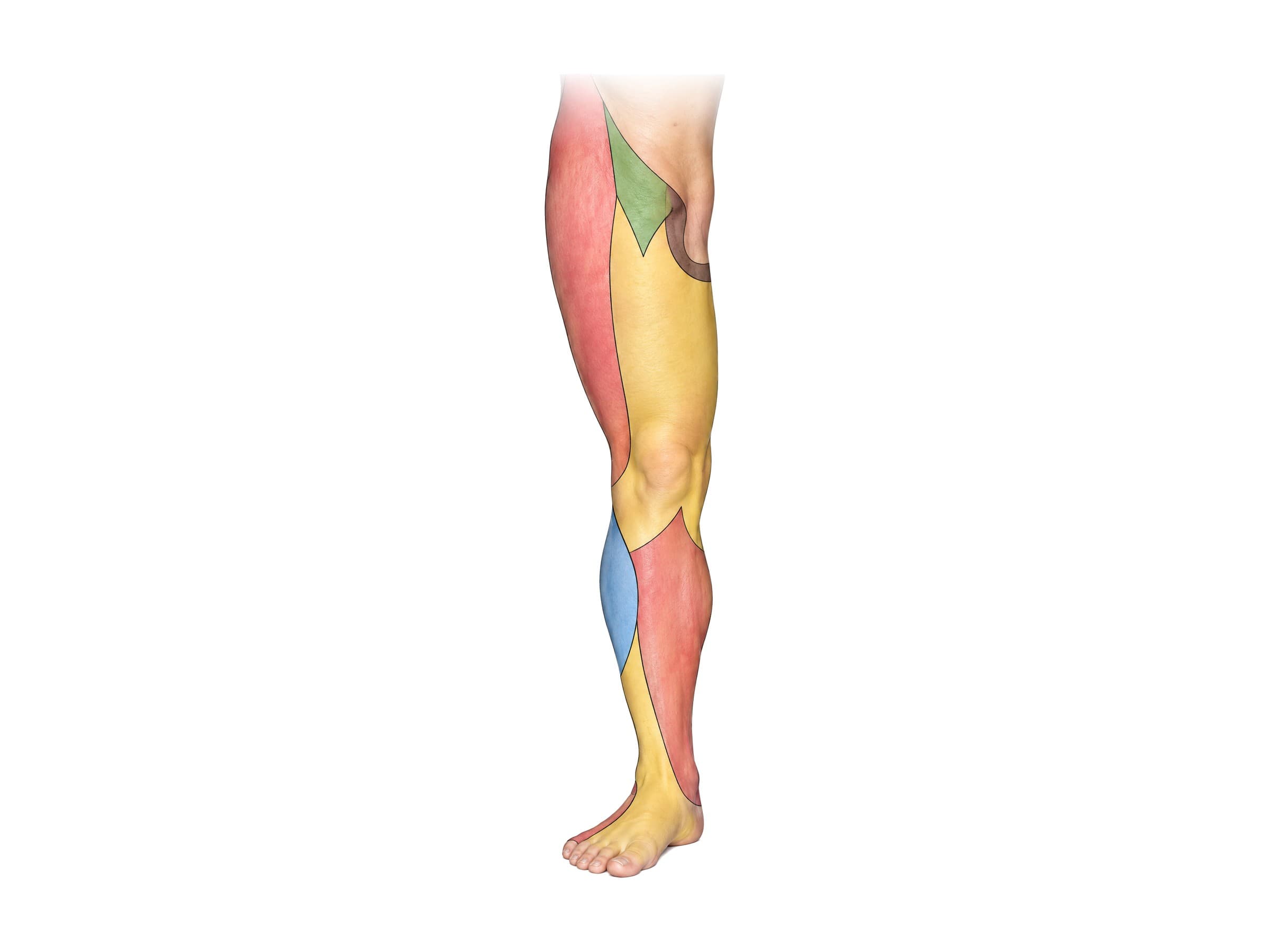 Cutaneous nerves of the leg (front view): saphenous, lateral femoral cutaneous and peroneal skin territories