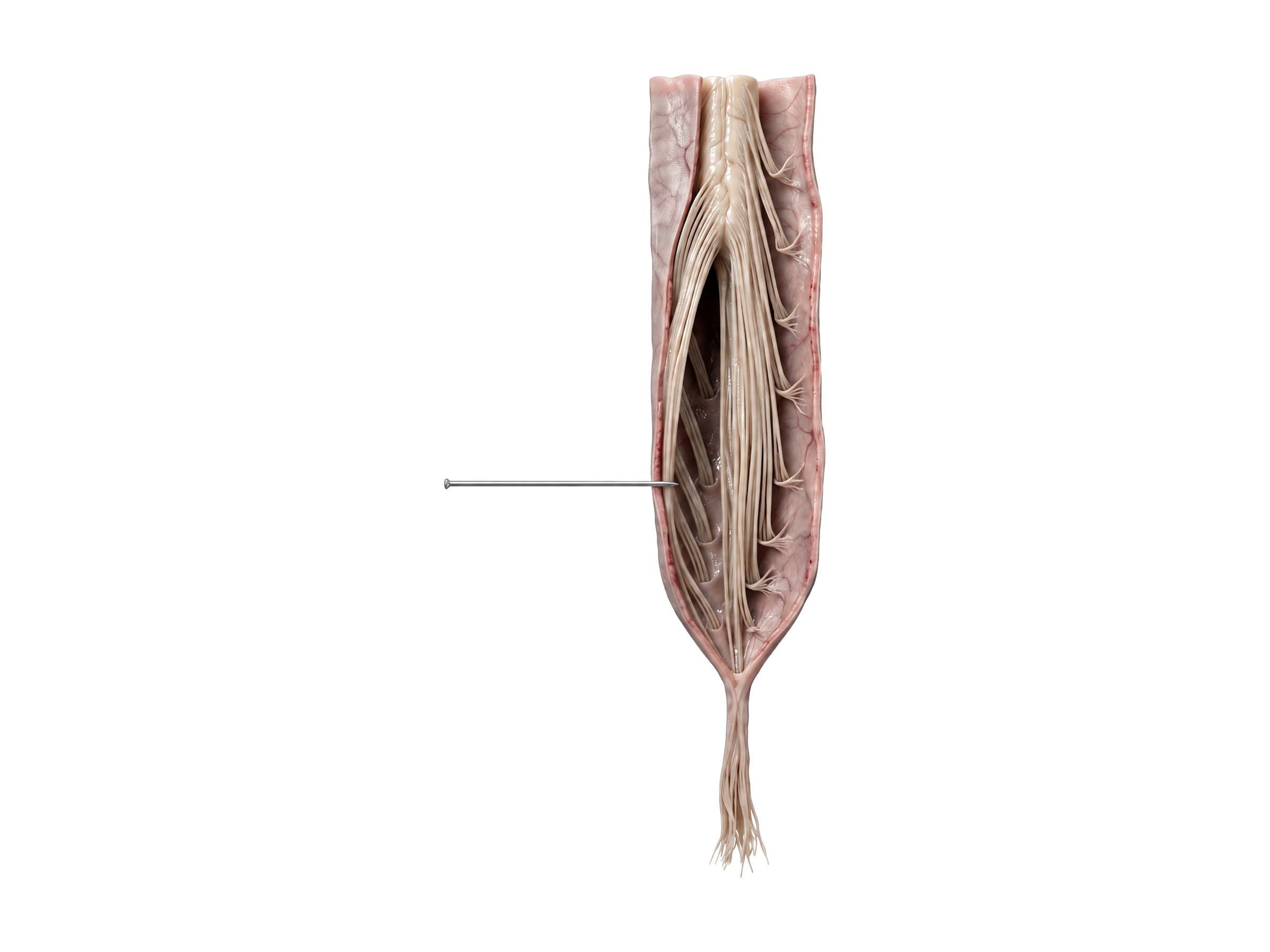 Cauda equina (dura opened from behind): conus medullaris, nerve roots and filum terminale