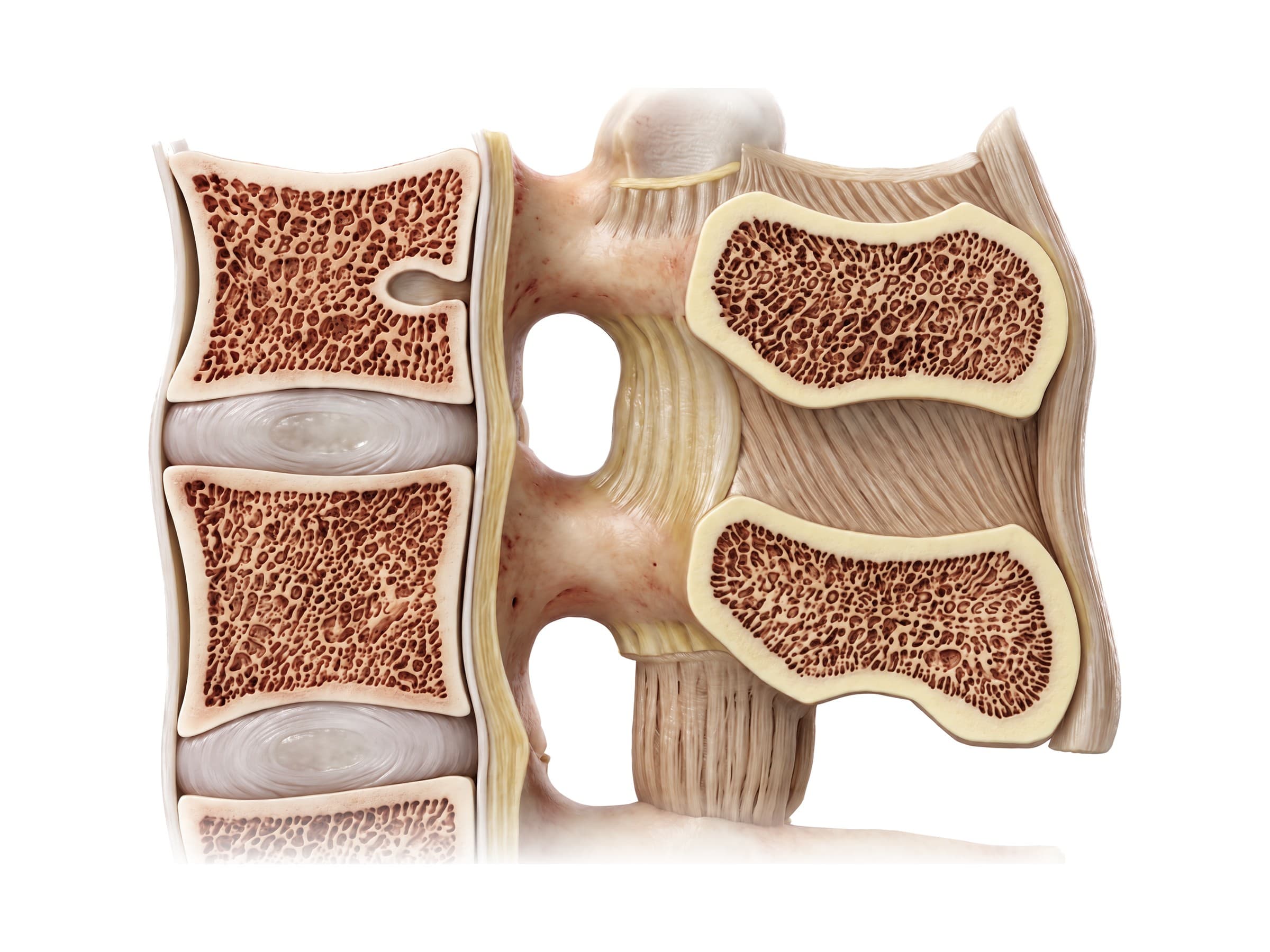 Ligaments of the lumbar spine (midline section): longitudinal ligaments, ligamentum flavum and discs