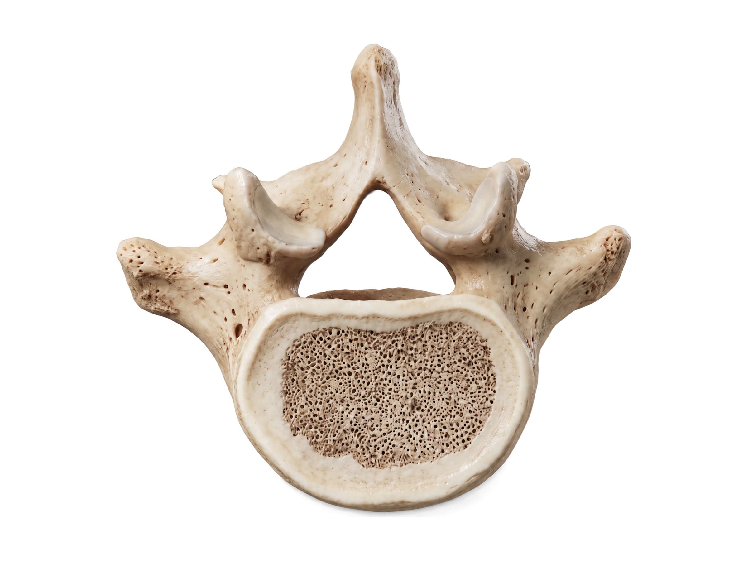 Lumbar vertebrae labeled (top view): body, pedicle, lamina, transverse and spinous processes
