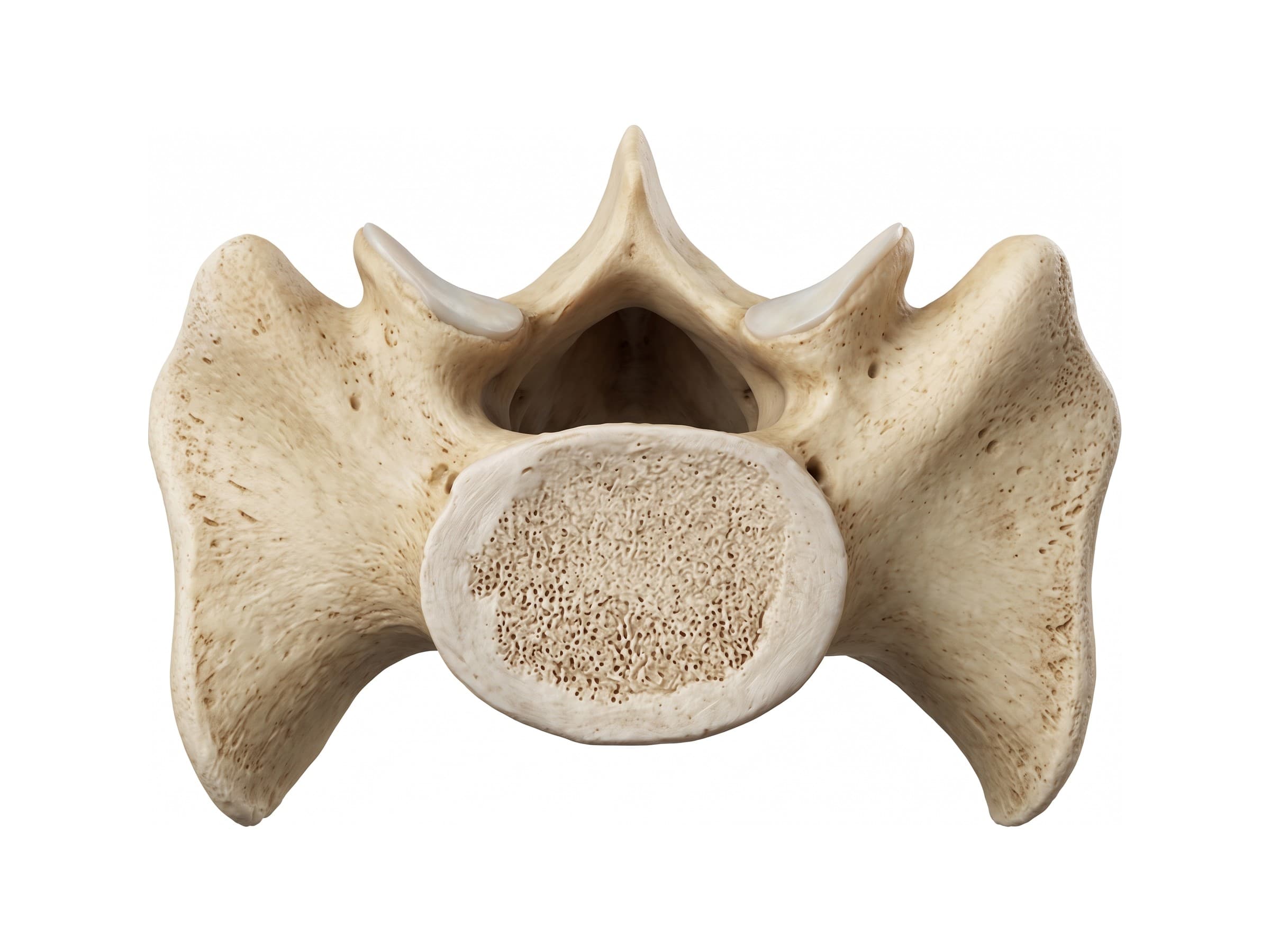 Base of the sacrum (top view): body of S1, sacral promontory, sacral ala and sacral canal