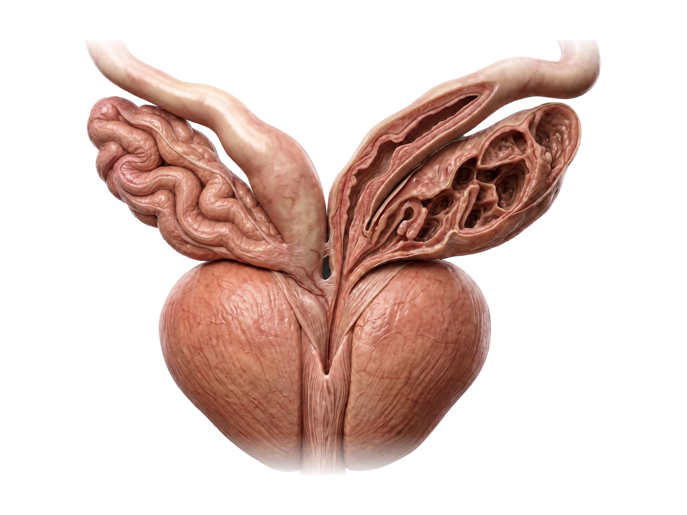Prostate anatomy (front view, opened): seminal vesicles, ampullae of the vas deferens, ejaculatory ducts and urethra