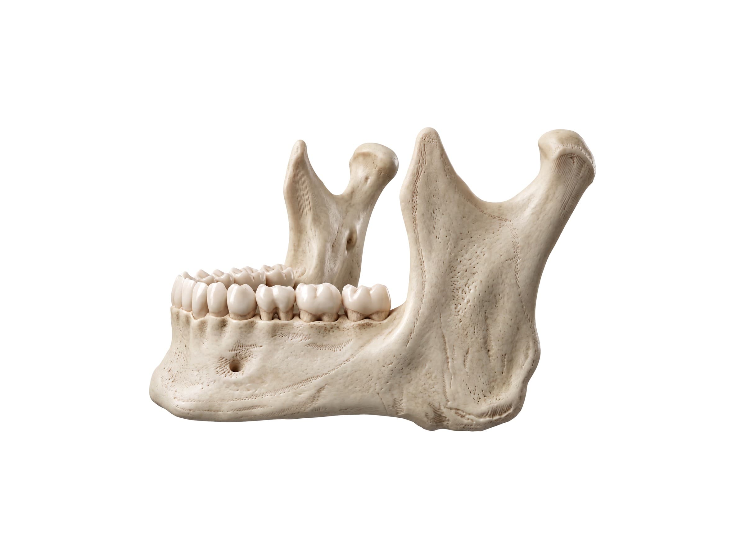 Mandible (jaw bone) anatomy: body, ramus, angle, condyle, coronoid process and mental foramen (left side)