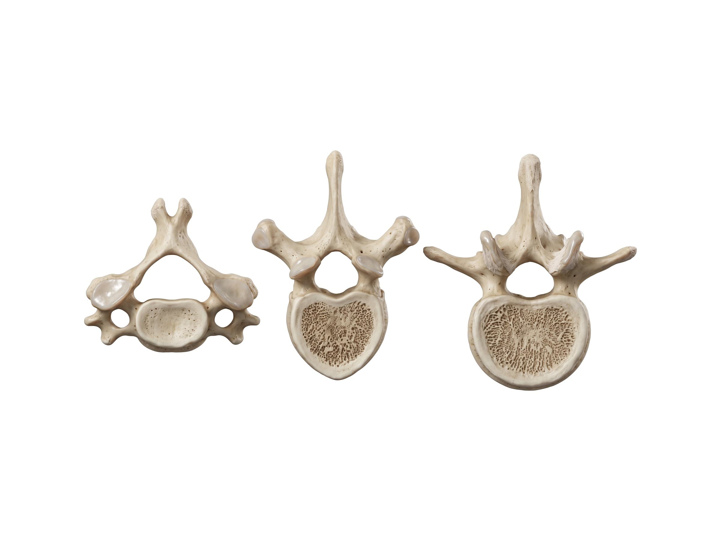 Vertebrae labeled (top view): a cervical, a thoracic and a lumbar vertebra compared side by side