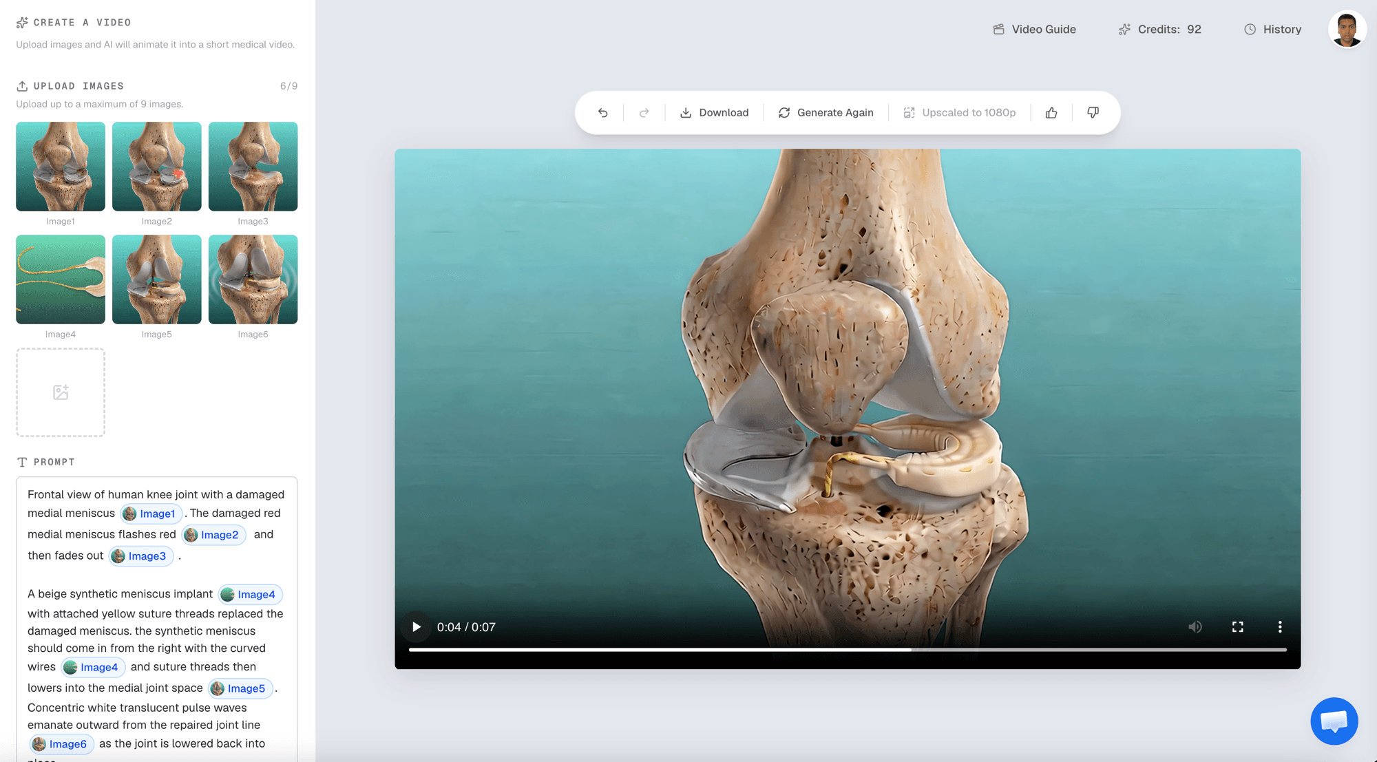 Natomy's AI video generator turning uploaded knee surgery images into a medical animation