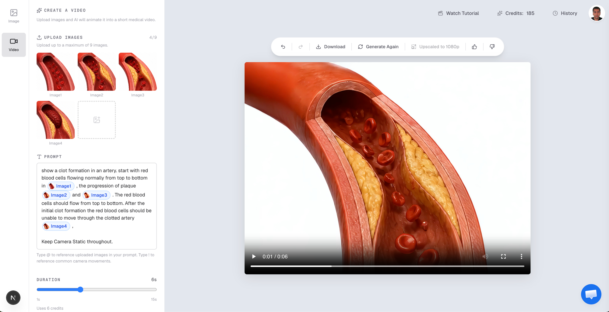 Natomy's video generation interface, showing uploaded reference images, a prompt with @Image references, and a generated animation of clot formation in an artery